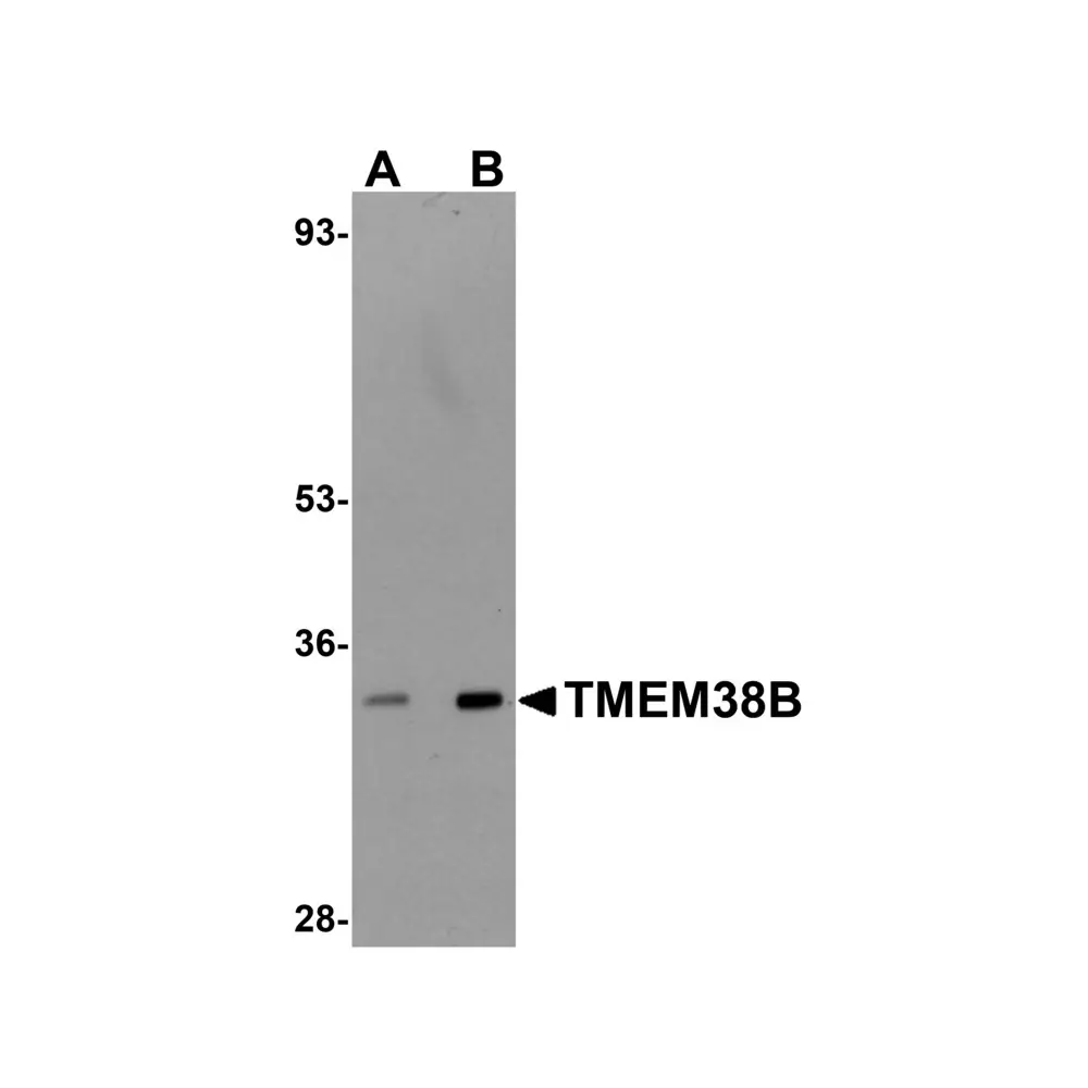 ProSci 5523_S TMEM38B Antibody, ProSci, 0.02 mg/Unit Primary Image