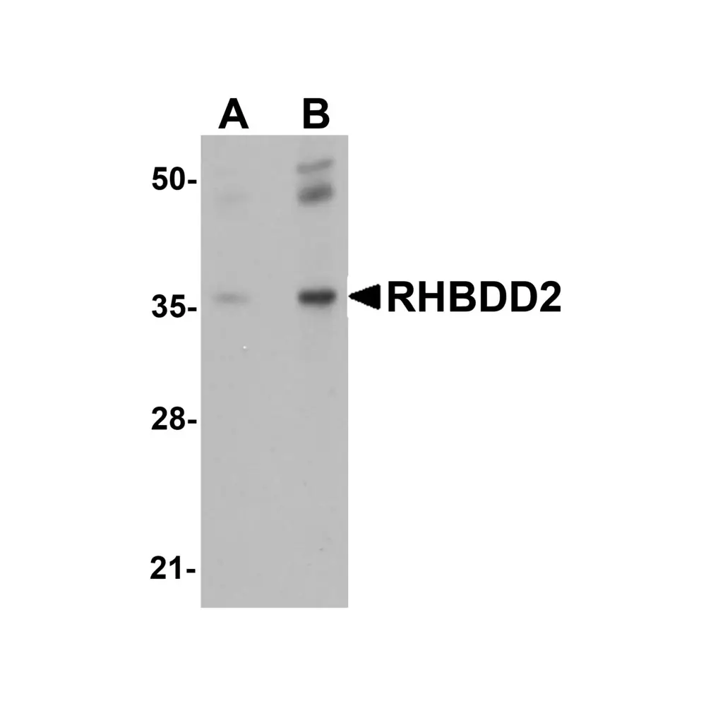 ProSci 5527 RHBDD2 Antibody, ProSci, 0.1 mg/Unit Primary Image