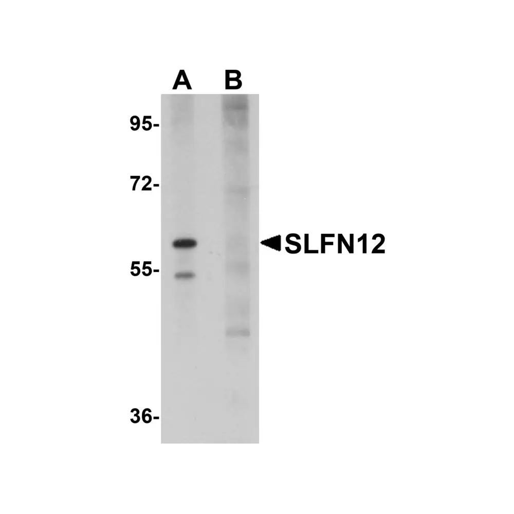 ProSci 5539_S SLFN12 Antibody, ProSci, 0.02 mg/Unit Primary Image