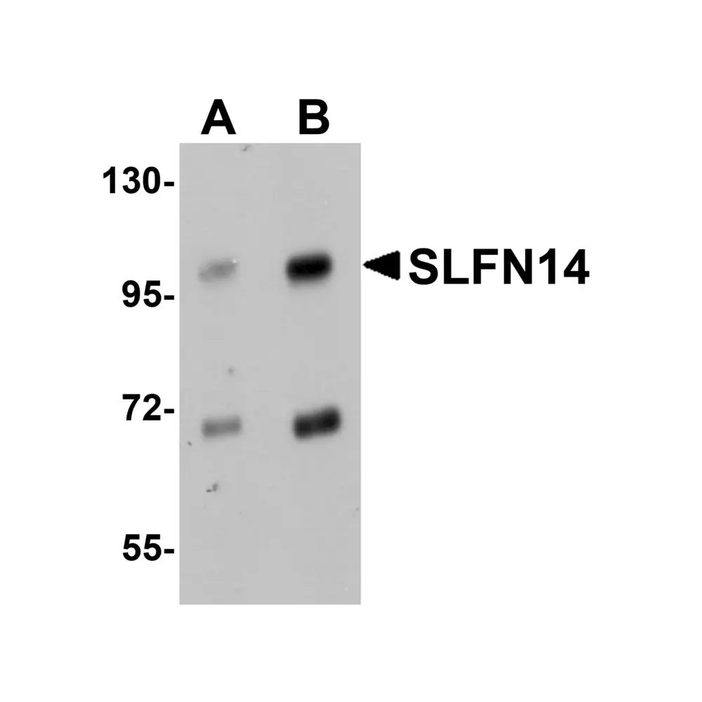 ProSci 5543_S SLFN14 Antibody, ProSci, 0.02 mg/Unit Primary Image