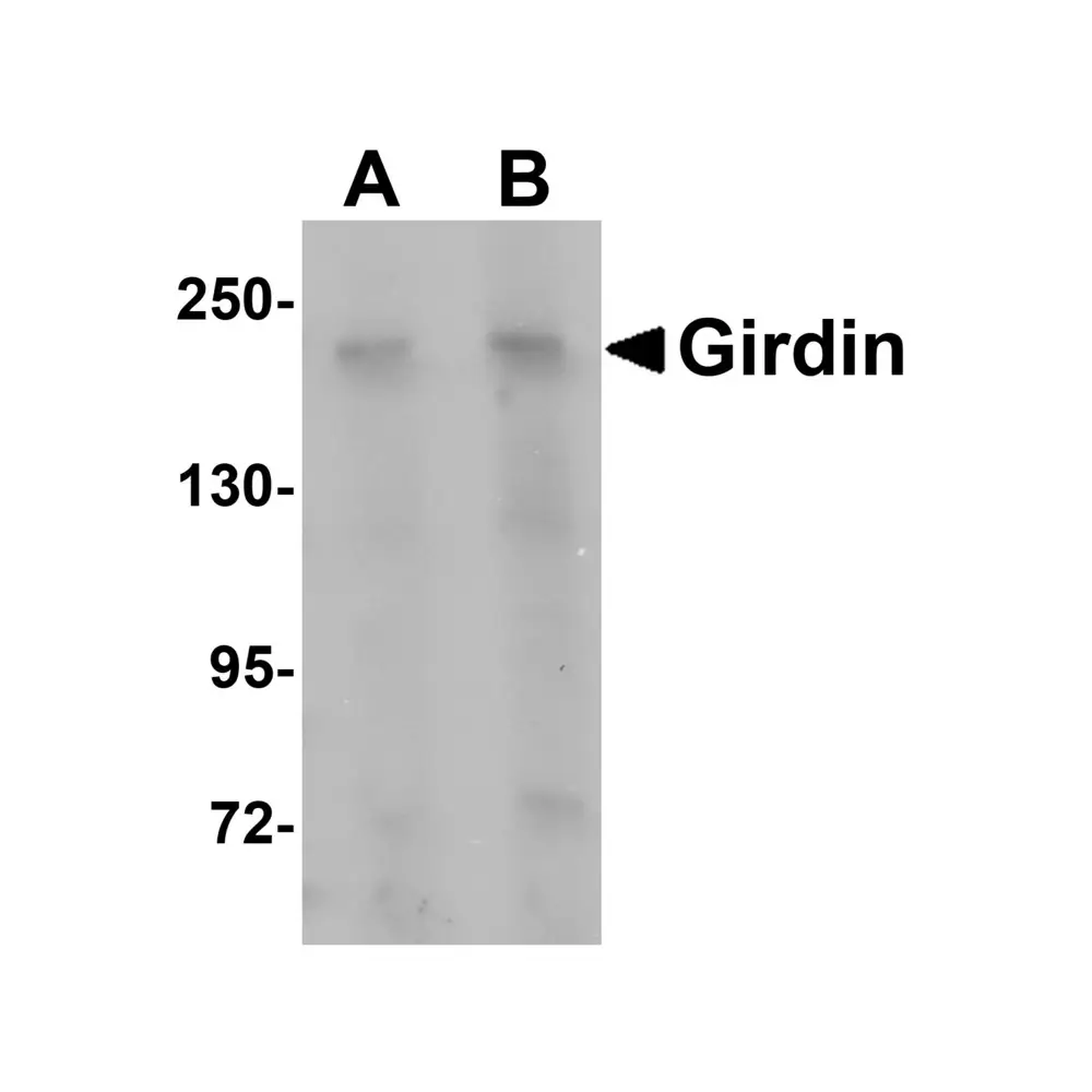 ProSci 5545 Girdin Antibody, ProSci, 0.1 mg/Unit Primary Image