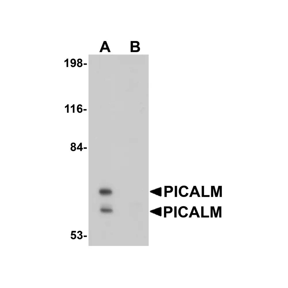 ProSci 5553 PICALM Antibody, ProSci, 0.1 mg/Unit Primary Image