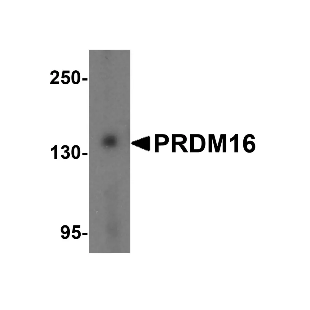 ProSci 5555 PRDM16 Antibody, ProSci, 0.1 mg/Unit Primary Image