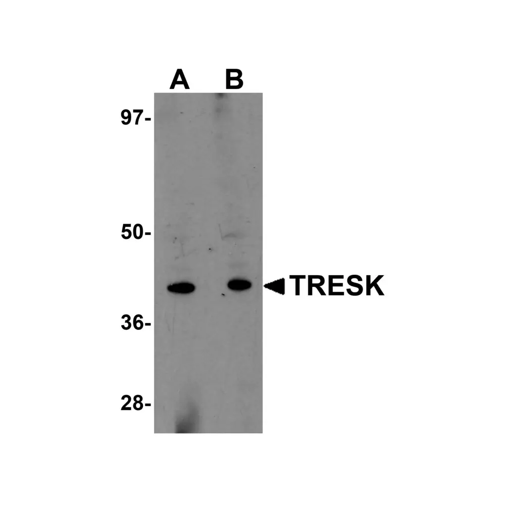 ProSci 5557 TRESK Antibody, ProSci, 0.1 mg/Unit Primary Image
