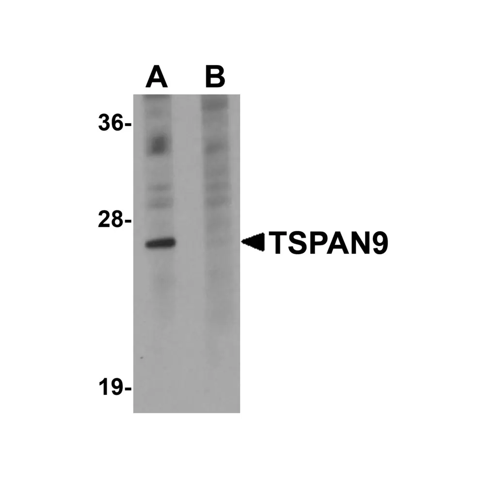 ProSci 5559 TSPAN9 Antibody, ProSci, 0.1 mg/Unit Primary Image