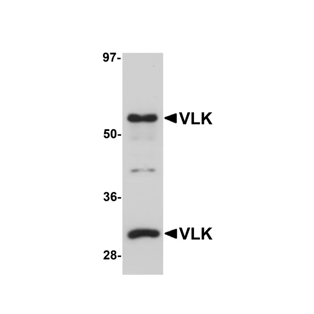 ProSci 5561 VLK Antibody, ProSci, 0.1 mg/Unit Primary Image