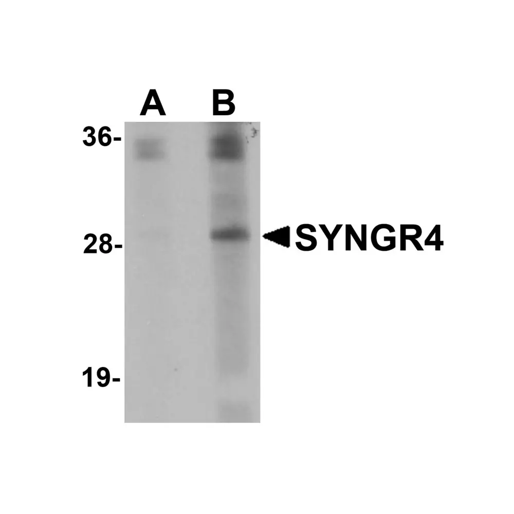 ProSci 5569 SYNGR4 Antibody, ProSci, 0.1 mg/Unit Primary Image