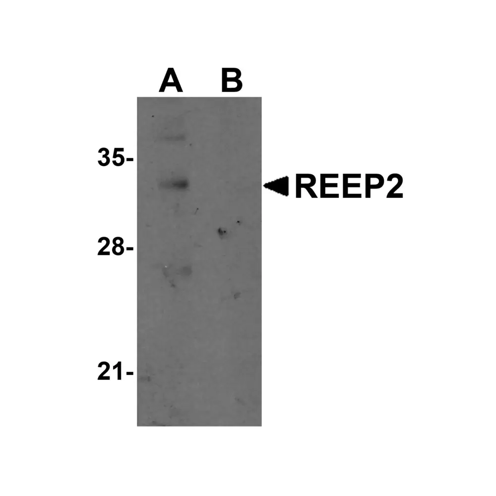 ProSci 5571 REEP2 Antibody, ProSci, 0.1 mg/Unit Primary Image