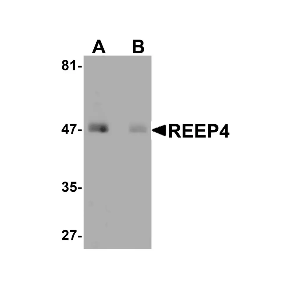 ProSci 5575 REEP4 Antibody, ProSci, 0.1 mg/Unit Primary Image