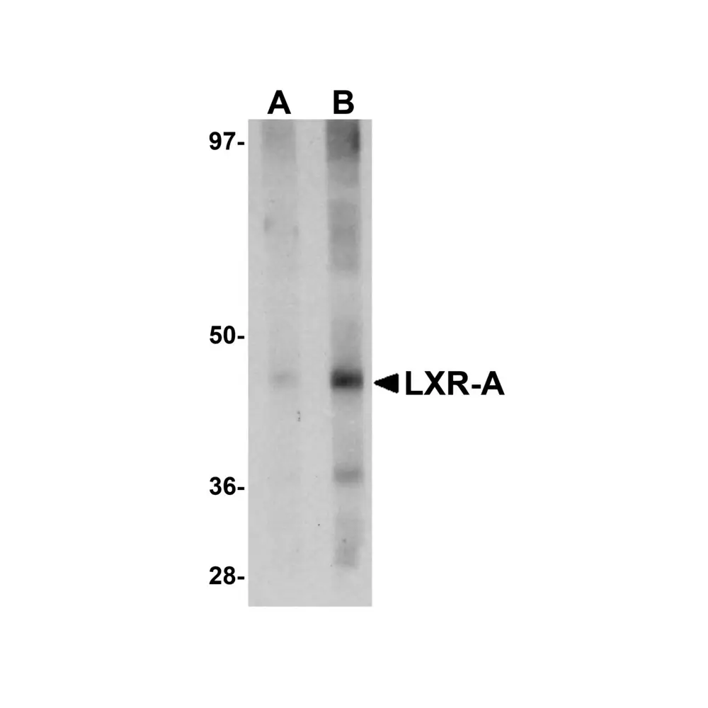 ProSci 5577 LXR-A Antibody, ProSci, 0.1 mg/Unit Primary Image