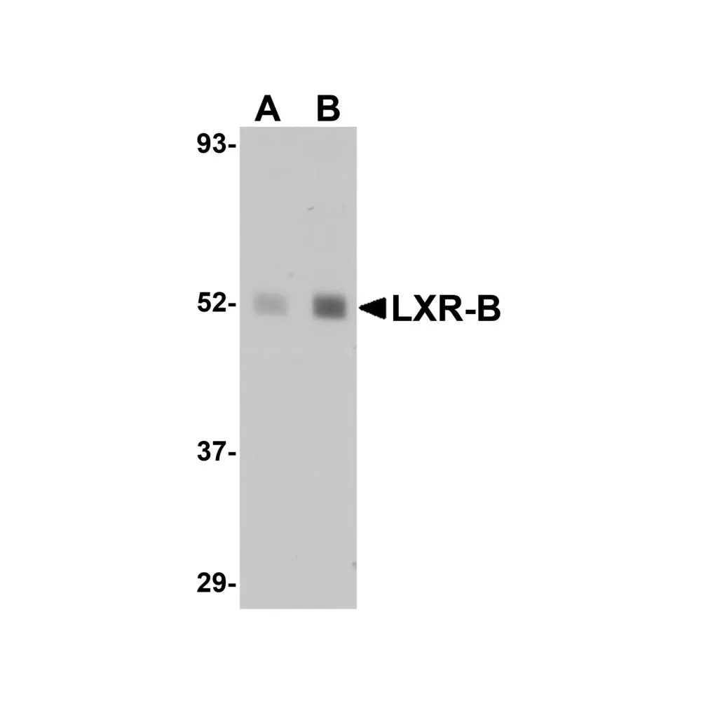 ProSci 5579_S LXR-B Antibody, ProSci, 0.02 mg/Unit Primary Image