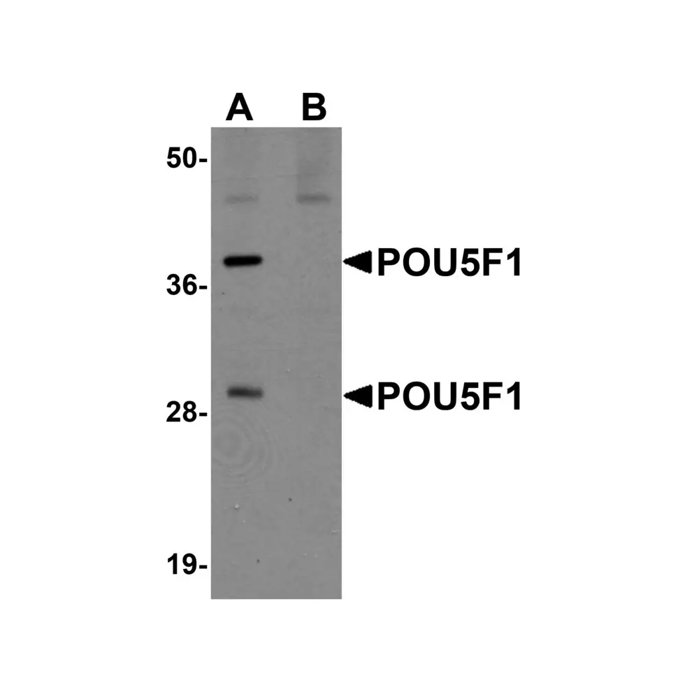 ProSci 5581 POU5F1 Antibody, ProSci, 0.1 mg/Unit Primary Image