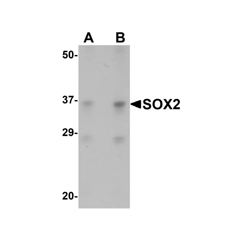 ProSci 5583 SOX2 Antibody, ProSci, 0.1 mg/Unit Primary Image