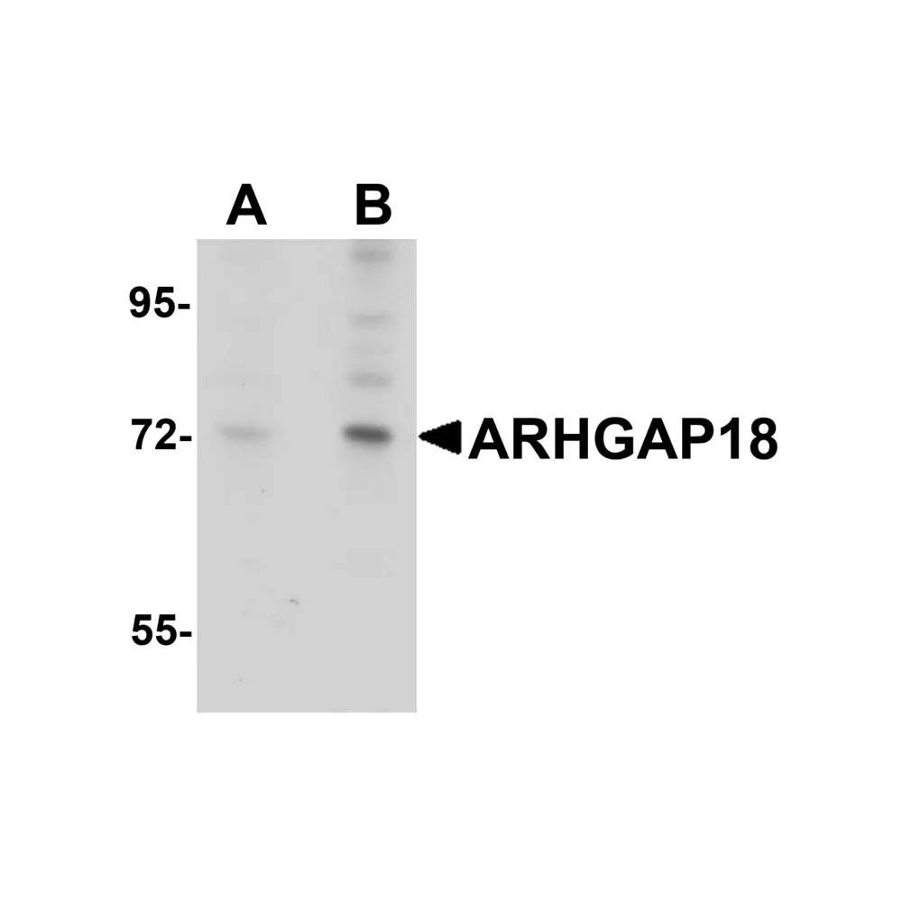 ProSci 5589 ARHGAP18 Antibody, ProSci, 0.1 mg/Unit Primary Image