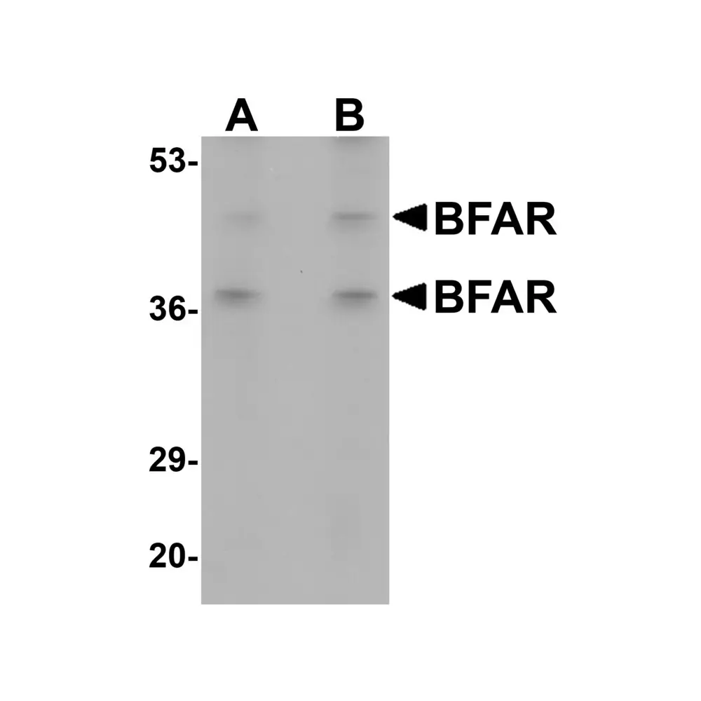 ProSci 5591_S BFAR Antibody, ProSci, 0.02 mg/Unit Primary Image