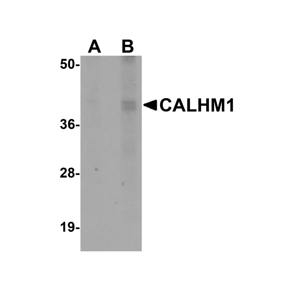 ProSci 5593 CALHM1 Antibody, ProSci, 0.1 mg/Unit Primary Image