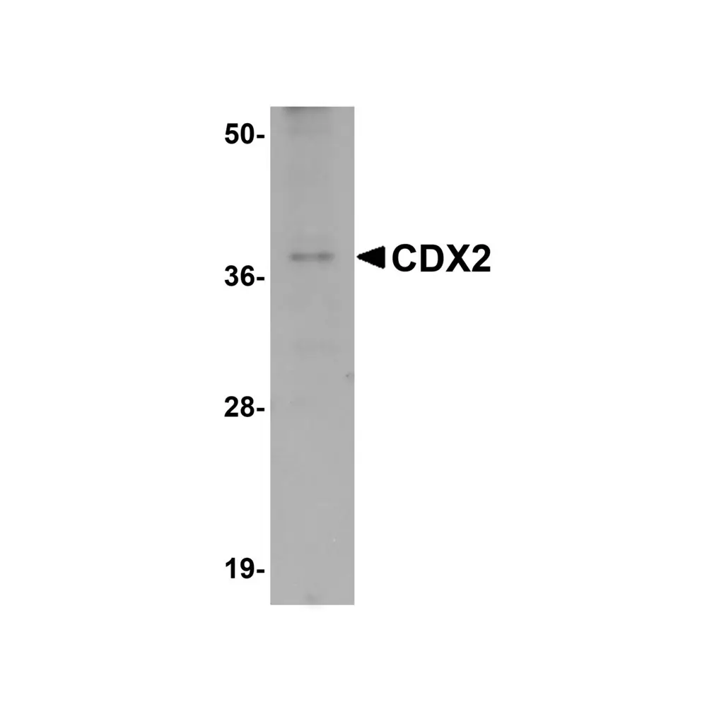 ProSci 5595_S CDX2 Antibody, ProSci, 0.02 mg/Unit Primary Image