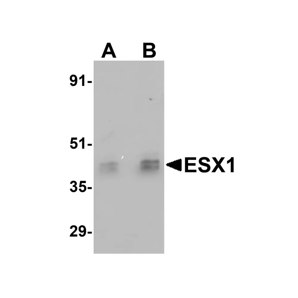 ProSci 5597 ESX1 Antibody, ProSci, 0.1 mg/Unit Primary Image