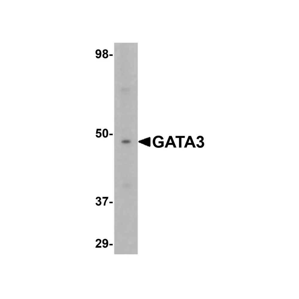 ProSci 5599 GATA3 Antibody, ProSci, 0.1 mg/Unit Primary Image