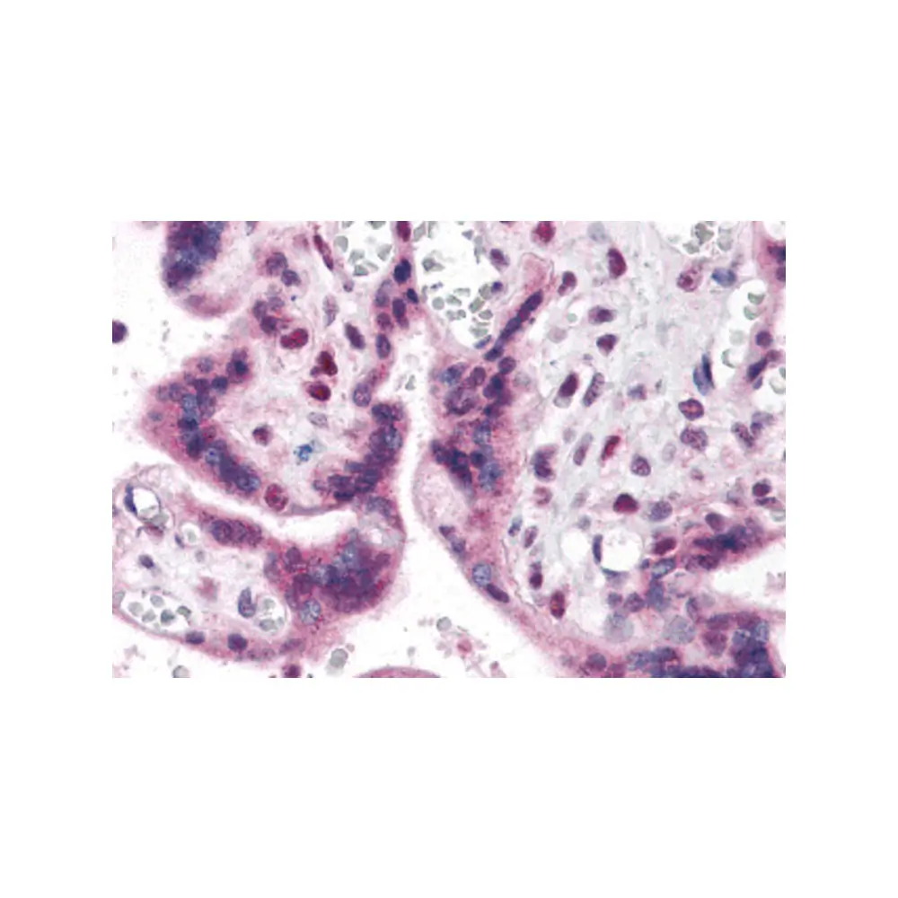 ProSci 5601 IRF2BP2 Antibody, ProSci, 0.1 mg/Unit Primary Image