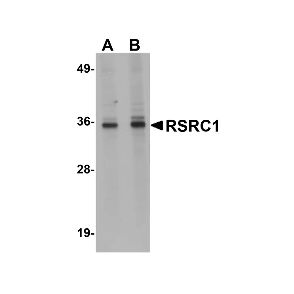 ProSci 5607 RSRC1 Antibody, ProSci, 0.1 mg/Unit Primary Image