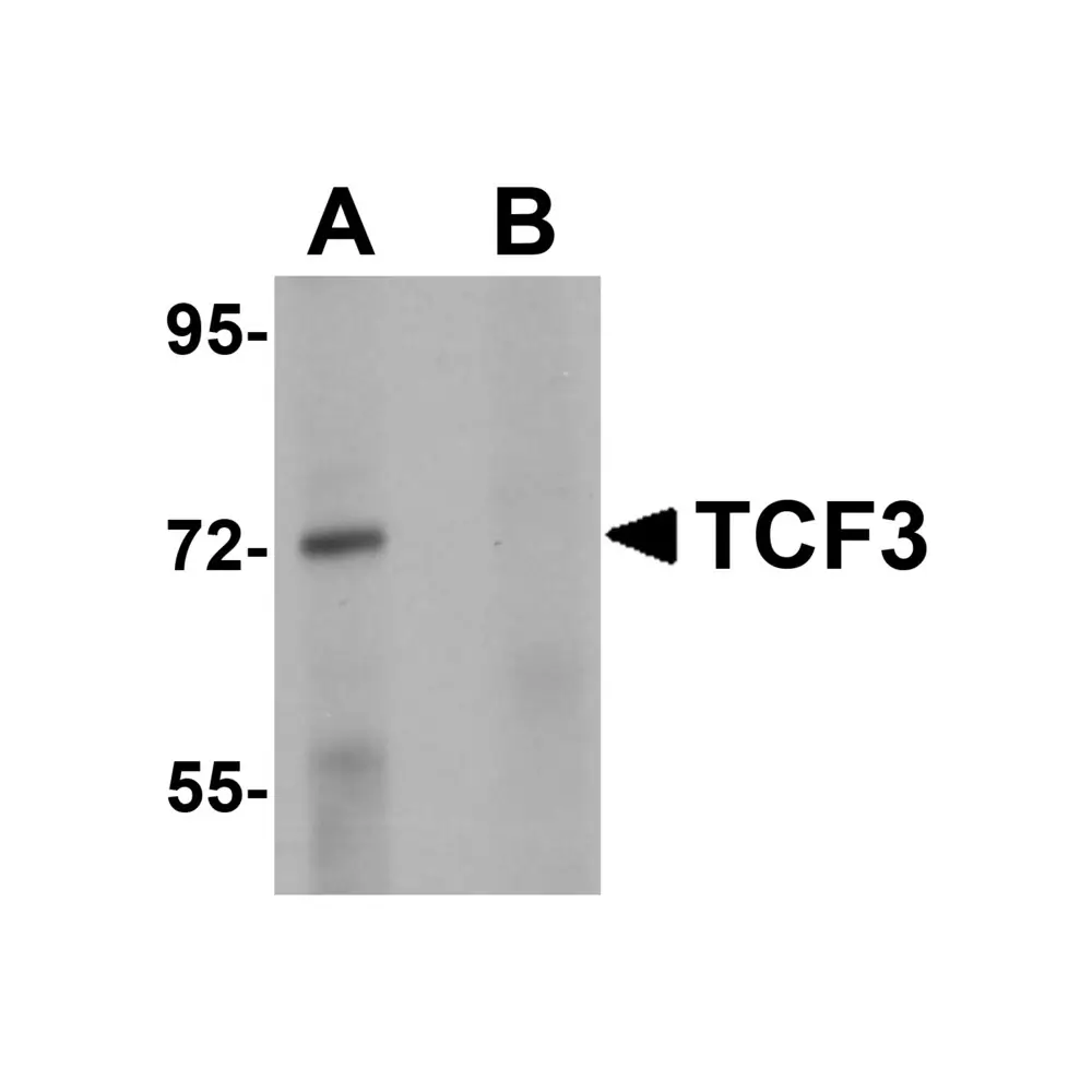 ProSci 5609 TCF3 Antibody, ProSci, 0.1 mg/Unit Primary Image