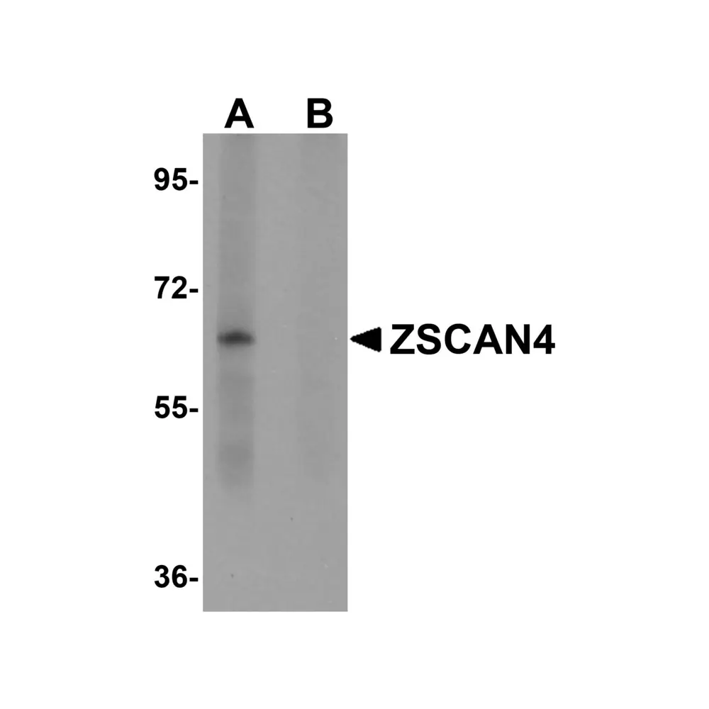 ProSci 5611_S ZSCAN4 Antibody, ProSci, 0.02 mg/Unit Primary Image