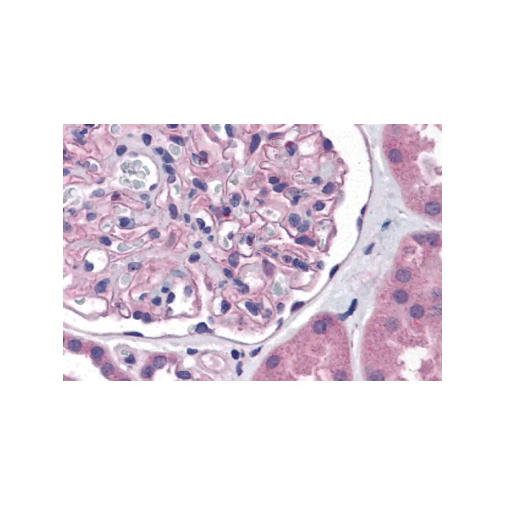 ProSci 5615_S Nephrin Antibody, ProSci, 0.02 mg/Unit Primary Image