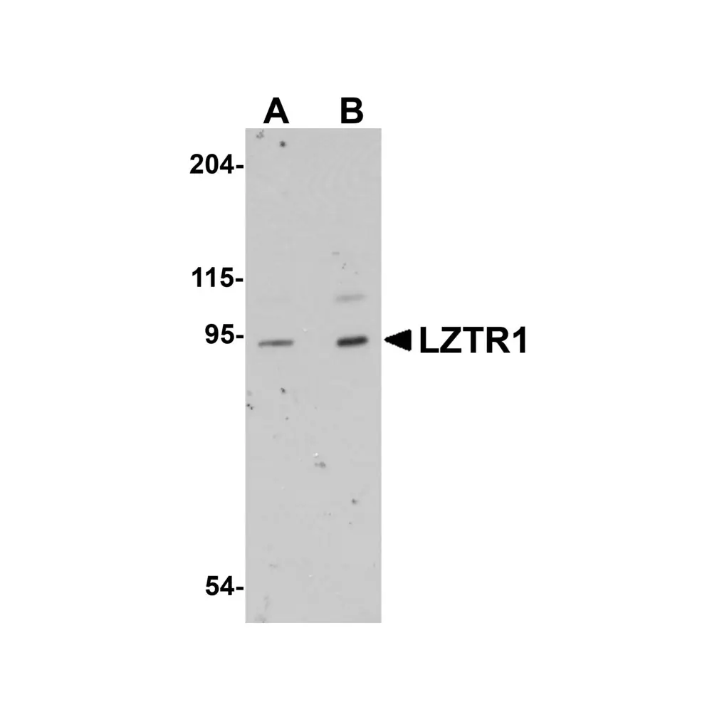 ProSci 5621 LZTR1 Antibody, ProSci, 0.1 mg/Unit Primary Image