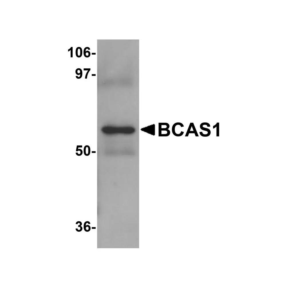 ProSci 5625 BCAS1 Antibody, ProSci, 0.1 mg/Unit Primary Image