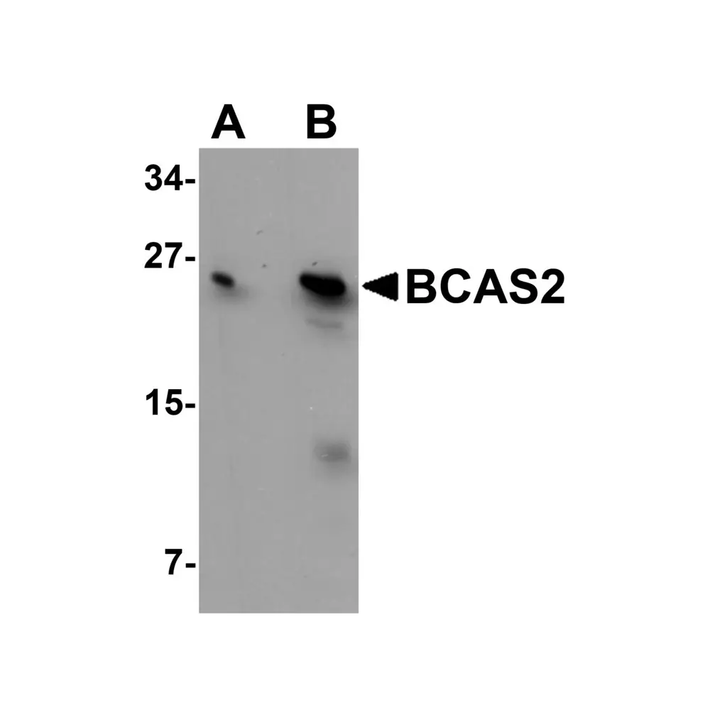 ProSci 5627 BCAS2 Antibody, ProSci, 0.1 mg/Unit Primary Image