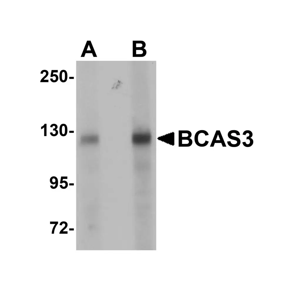 ProSci 5629 BCAS3 Antibody, ProSci, 0.1 mg/Unit Primary Image