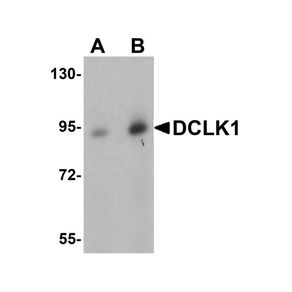 ProSci 5633 DCLK1 Antibody, ProSci, 0.1 mg/Unit Primary Image