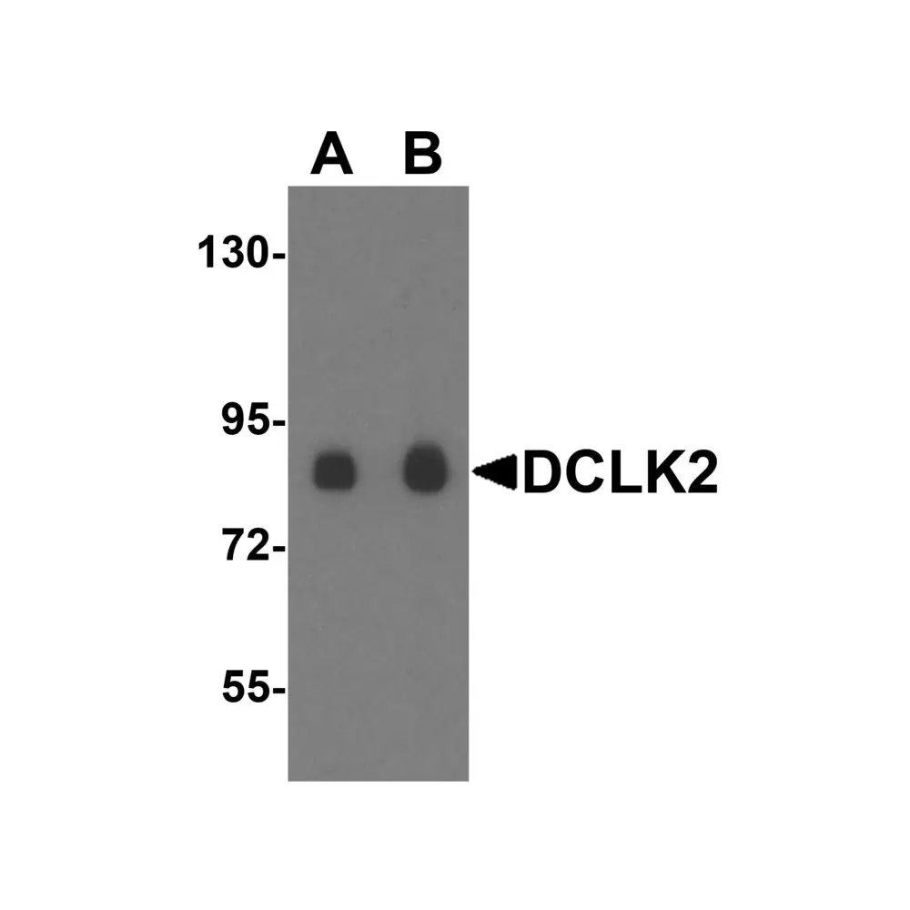 ProSci 5635 DCLK2 Antibody, ProSci, 0.1 mg/Unit Primary Image