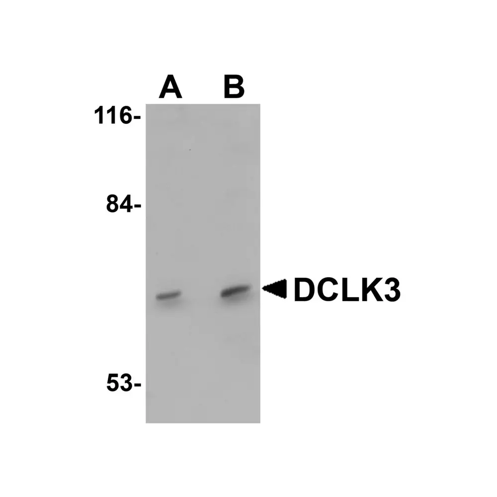 ProSci 5637 DCLK3 Antibody, ProSci, 0.1 mg/Unit Primary Image