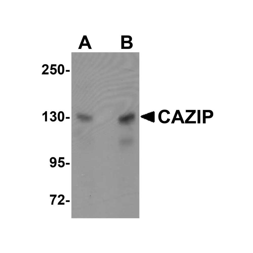 ProSci 5639 CAZIP Antibody, ProSci, 0.1 mg/Unit Primary Image