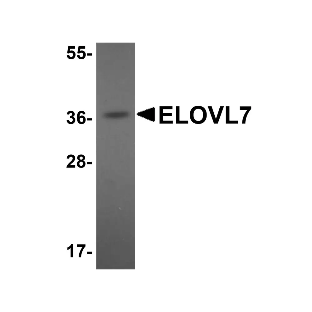 ProSci 5641 ELOVL7 Antibody, ProSci, 0.1 mg/Unit Primary Image