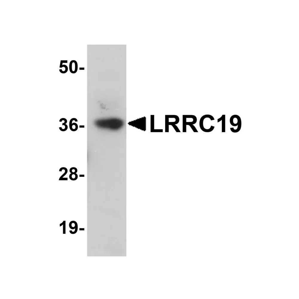ProSci 5643 LRRC19 Antibody, ProSci, 0.1 mg/Unit Primary Image