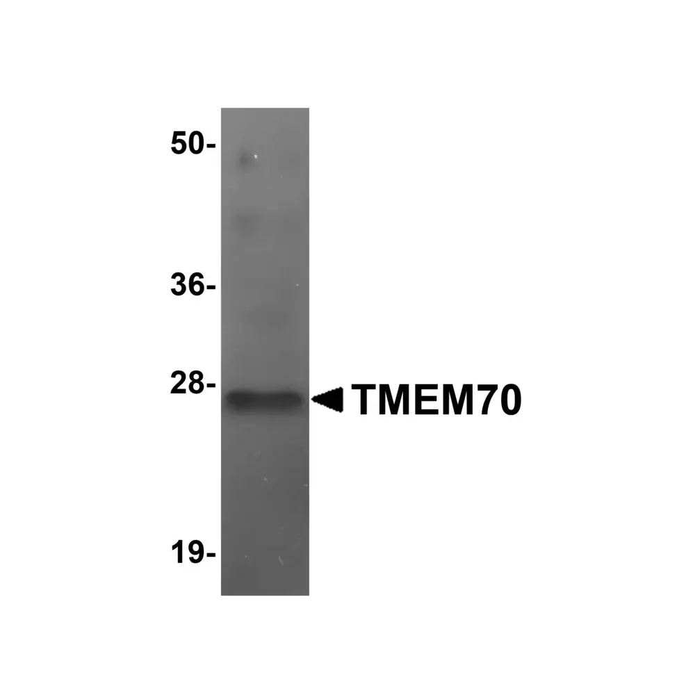 ProSci 5645_S TMEM70 Antibody, ProSci, 0.02 mg/Unit Primary Image