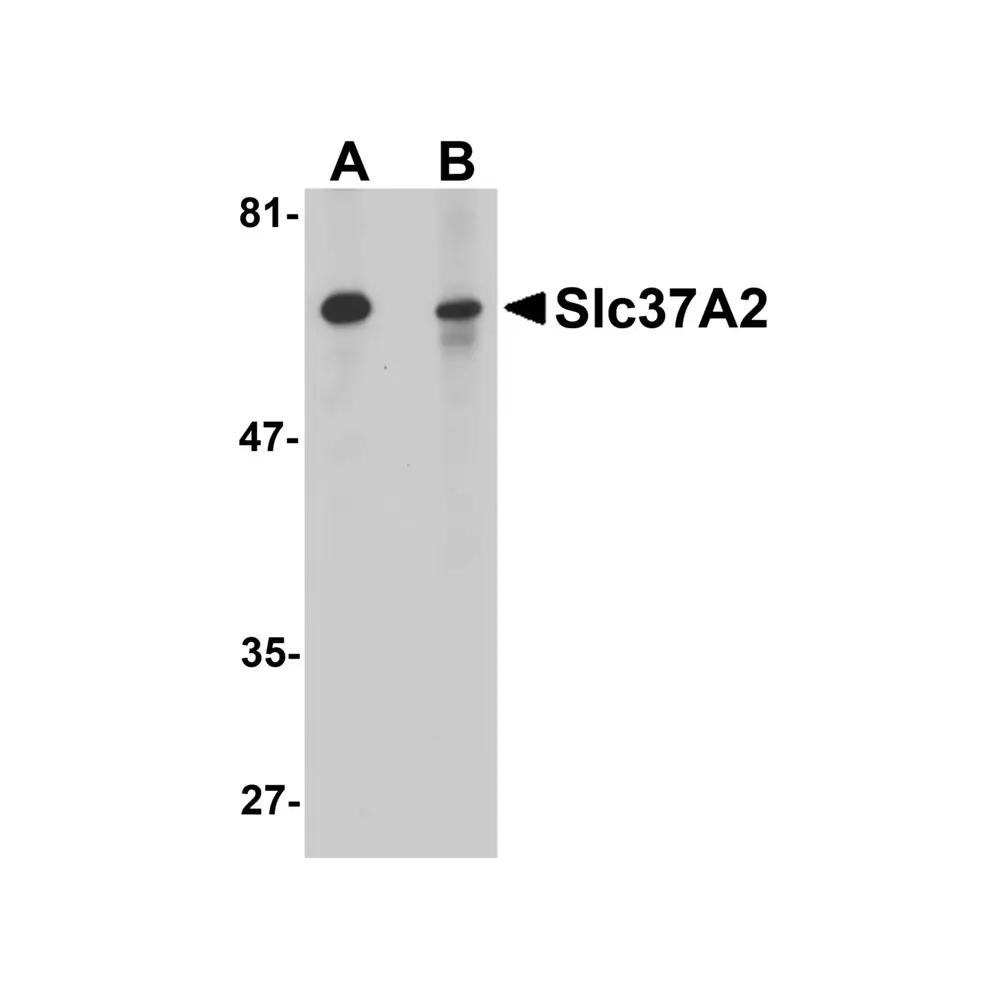 ProSci 5647 Slc37A2 Antibody, ProSci, 0.1 mg/Unit Primary Image