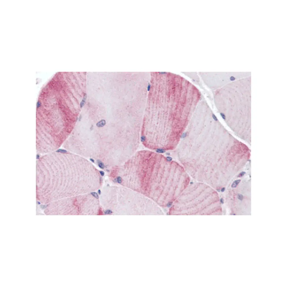 ProSci 5649 MYBPC1 Antibody, ProSci, 0.1 mg/Unit Primary Image