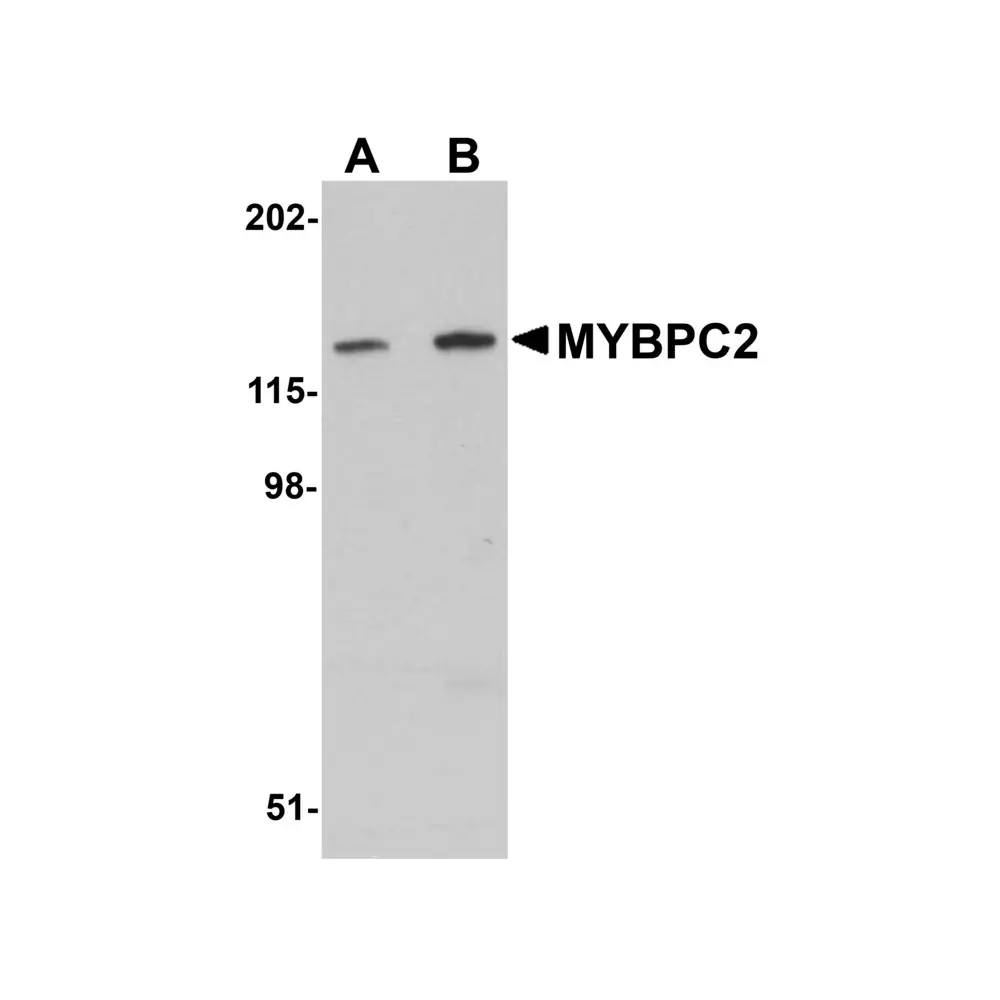 ProSci 5651 MYBPC2 Antibody, ProSci, 0.1 mg/Unit Primary Image