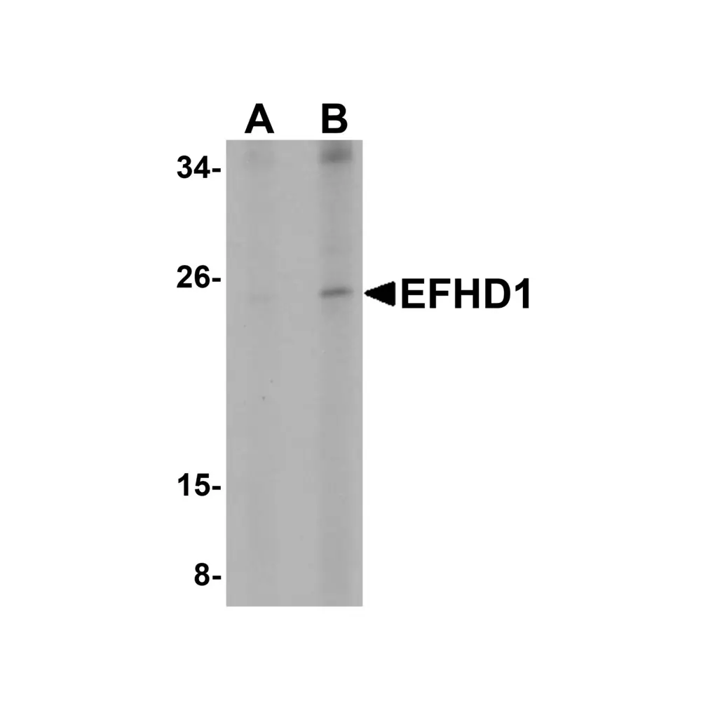 ProSci 5655 EFHD1 Antibody, ProSci, 0.1 mg/Unit Primary Image