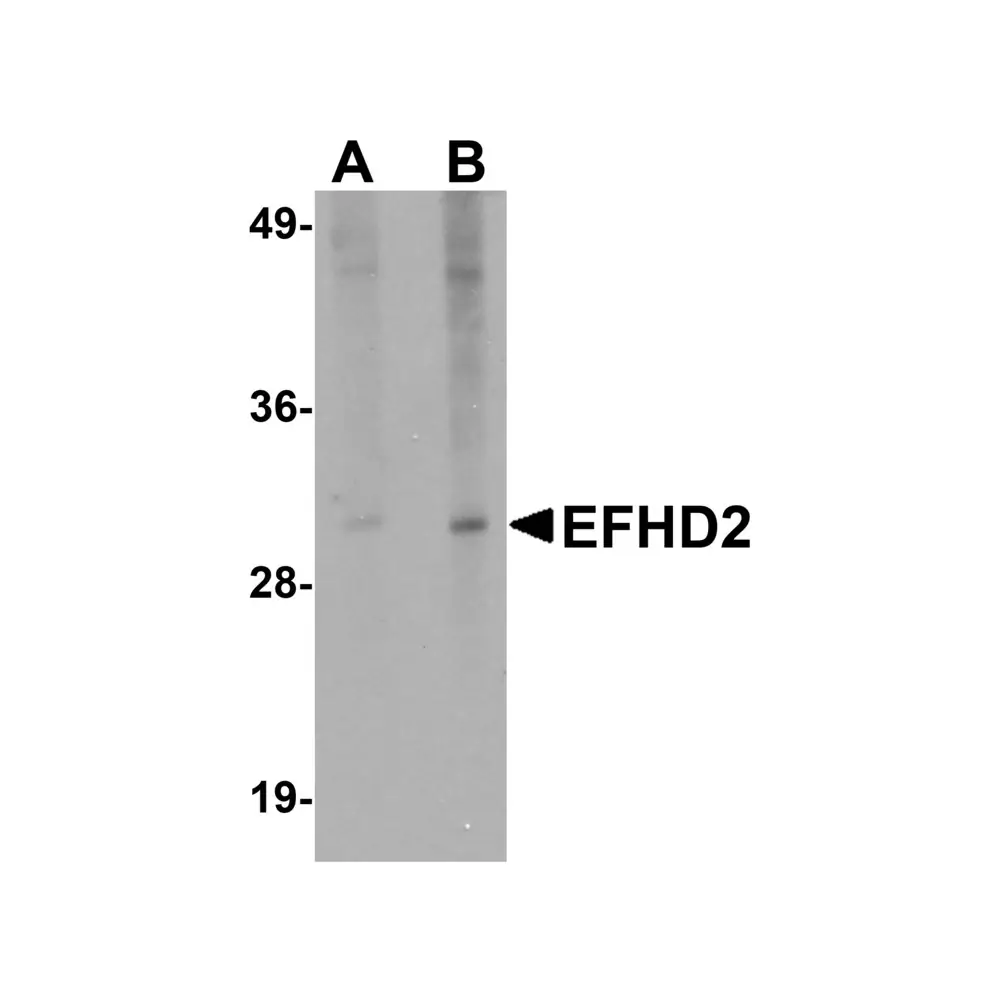 ProSci 5657_S EFHD2 Antibody, ProSci, 0.02 mg/Unit Primary Image