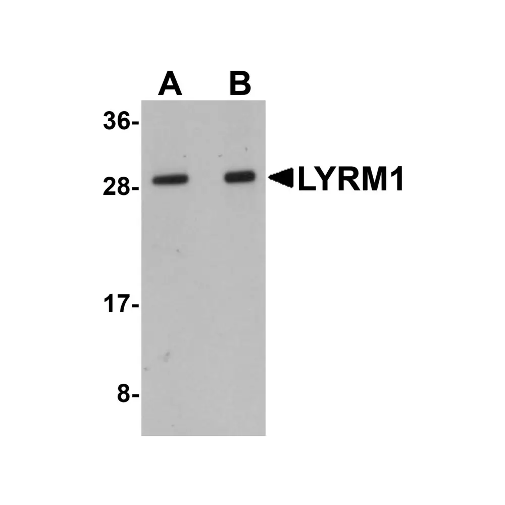 ProSci 5659 LYRM1 Antibody, ProSci, 0.1 mg/Unit Primary Image