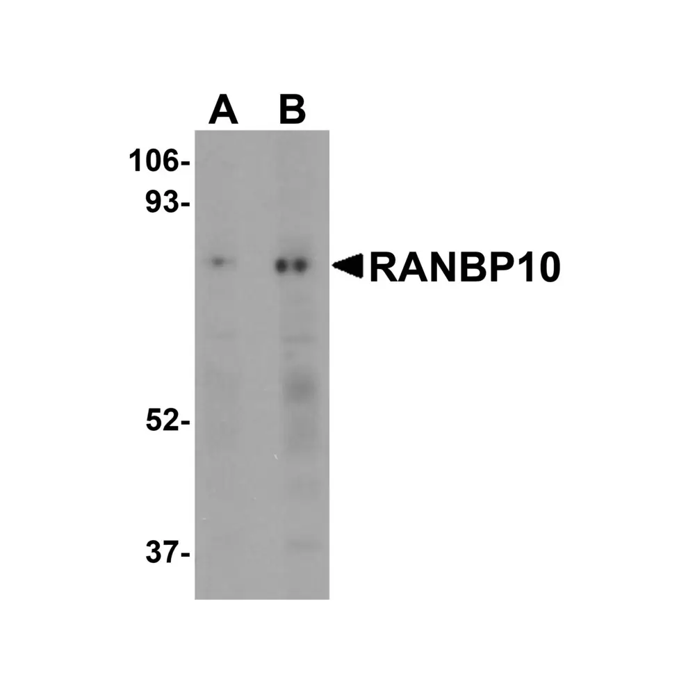 ProSci 5665 RANBP10 Antibody, ProSci, 0.1 mg/Unit Primary Image