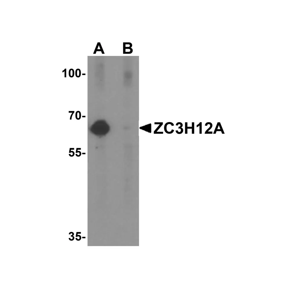 ProSci 5673 ZC3H12A Antibody, ProSci, 0.1 mg/Unit Primary Image