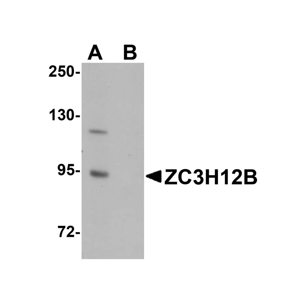 ProSci 5675 ZC3H12B Antibody, ProSci, 0.1 mg/Unit Primary Image