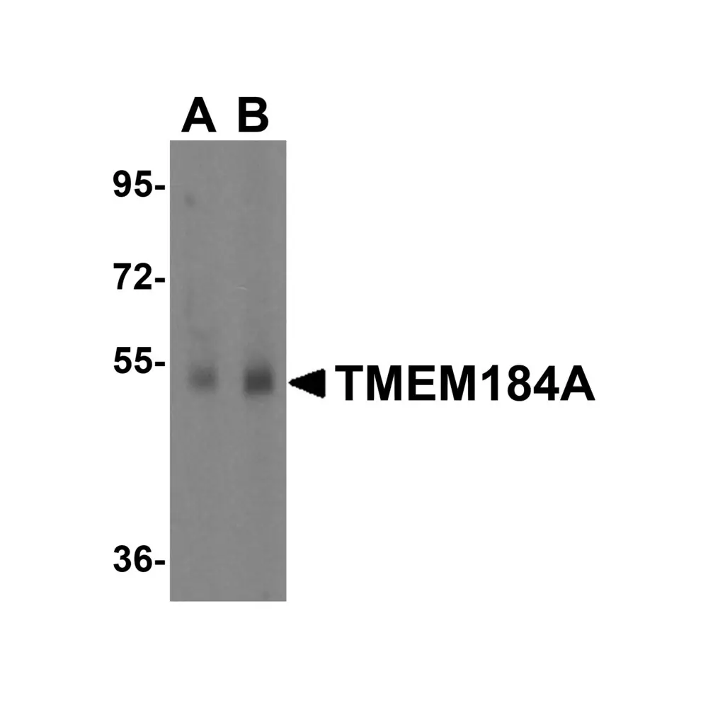 ProSci 5681_S TMEM184A Antibody, ProSci, 0.02 mg/Unit Primary Image