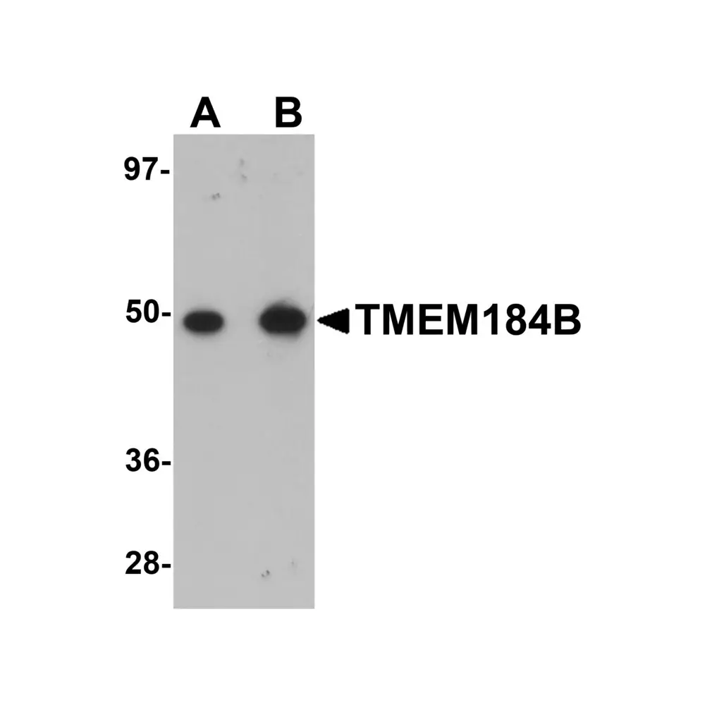ProSci 5683 TMEM184B Antibody, ProSci, 0.1 mg/Unit Primary Image